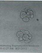 Two 8-Cell Embryos.png