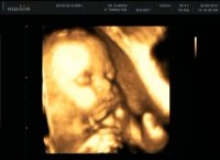 Molly 29 Week Scan.jpg