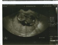 09-27-2013 03;32;31PM.jpg