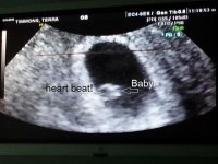 6 weeks 6 days - heart beat 133 bpm.jpg