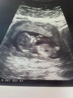 baby number 2.jpg