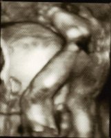 Baby Whyte...jpg
