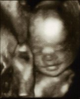 Baby Whyte..jpg