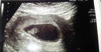 8 week scan.jpg