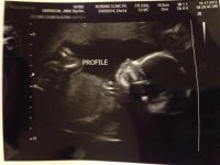 baby20week7.jpg