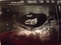 baby20week4.jpg