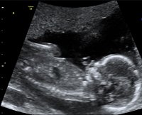 baby A 17W.jpg