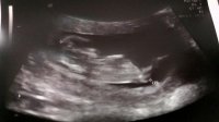 baby12weeks.jpg