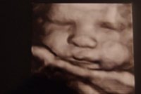 MT_4D scan_34weeks2.jpg