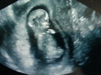 12 weeks baby's side view.jpg