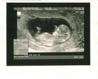 11_Week_Scan_2.jpg