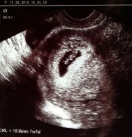 Bean_7weeks_crop.jpg