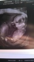 Baby BOY #2 3D at 12 weeks.jpg