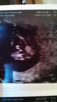 Baby #2 at 12 weeks.jpg