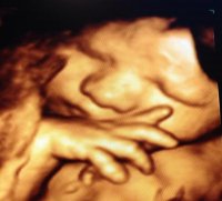 baby2.jpg
