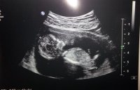 baby2-12weeks.jpg