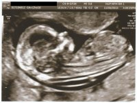 Baby03gp.jpg