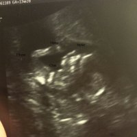 13 weeks and 2 days profile.jpg