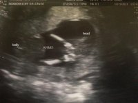 13 weeks and 3 days arms and head.jpg