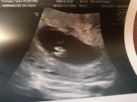 13 weeks and 3 days feet.jpg
