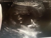 13 weeks and 3 days foot and head.jpg