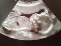 wiggles20wks.jpg