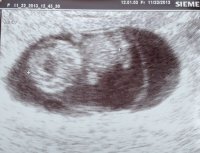 BabyPanda_9weeks_crop.jpg