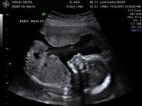 RACHEL 20 WKS_4.jpg