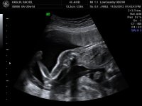 RACHEL 20 WKS_15.jpg