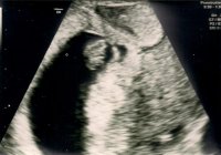 Baby 6w5d0000.jpg