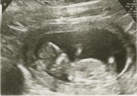 Baby Scan 12wks 007.jpg