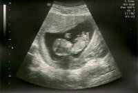 Baby 11w 3d0000.jpg