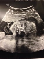 face - 23 weeks.JPG