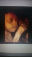 baby2.jpg baby2.jpg
