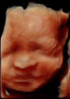 CROP_BABY LENIS 13-12-2013_26.jpg