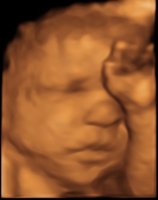 CROP_BABY LENIS 13-12-2013_45.jpg