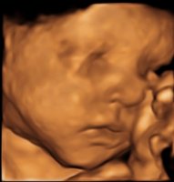 CROP_BABY LENIS 13-12-2013_54.jpg