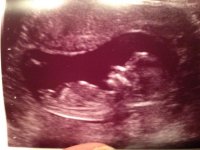 baby 13 weeks 1 day.jpg