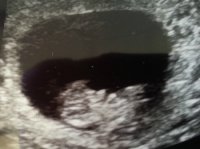 baby2 pic 2.jpg