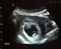 8 Weeks 1 Day<3.jpg