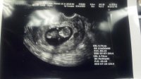 Geebaby10w6d.jpg