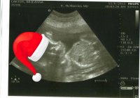 ultrasound with santa hat1.jpg