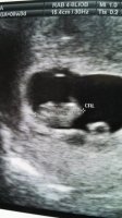 ultrasound.jpg