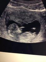 BABY #2 12W.jpg