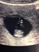 Baby #2 (4).jpg