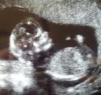 BabyGee12w5d.jpg