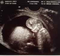 Baby B#2 12Week Ultrasound.jpg
