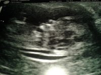 12 week new baby.jpg