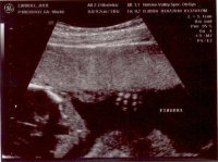 baby 19 weeks 1.jpg