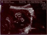 baby 19 weeks 3.jpg